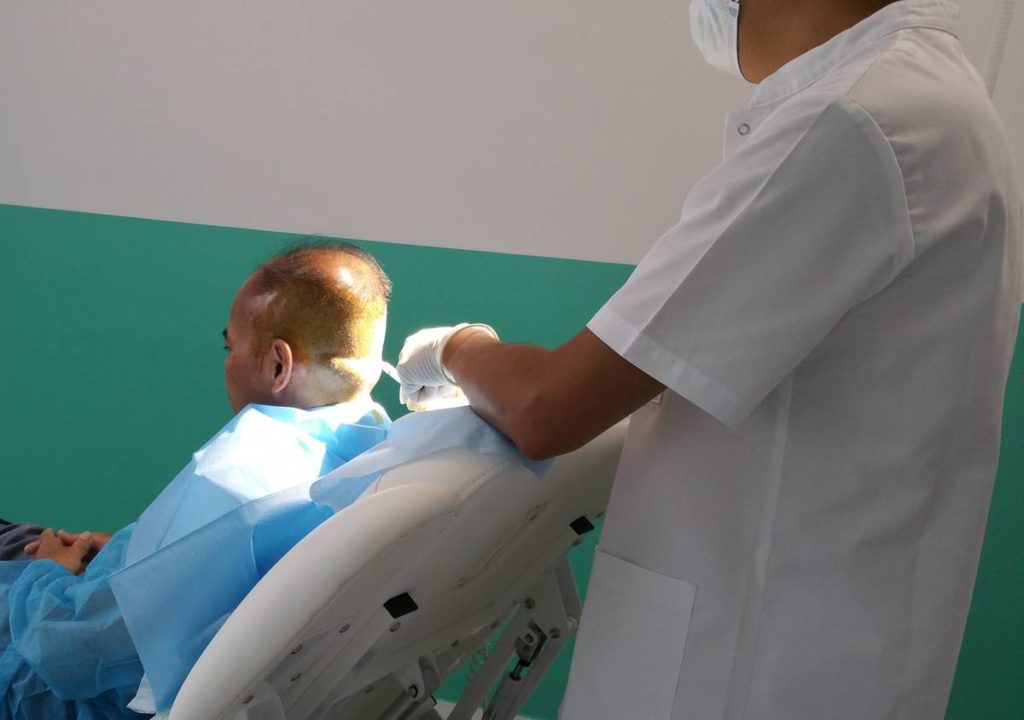 hair transplant Paris