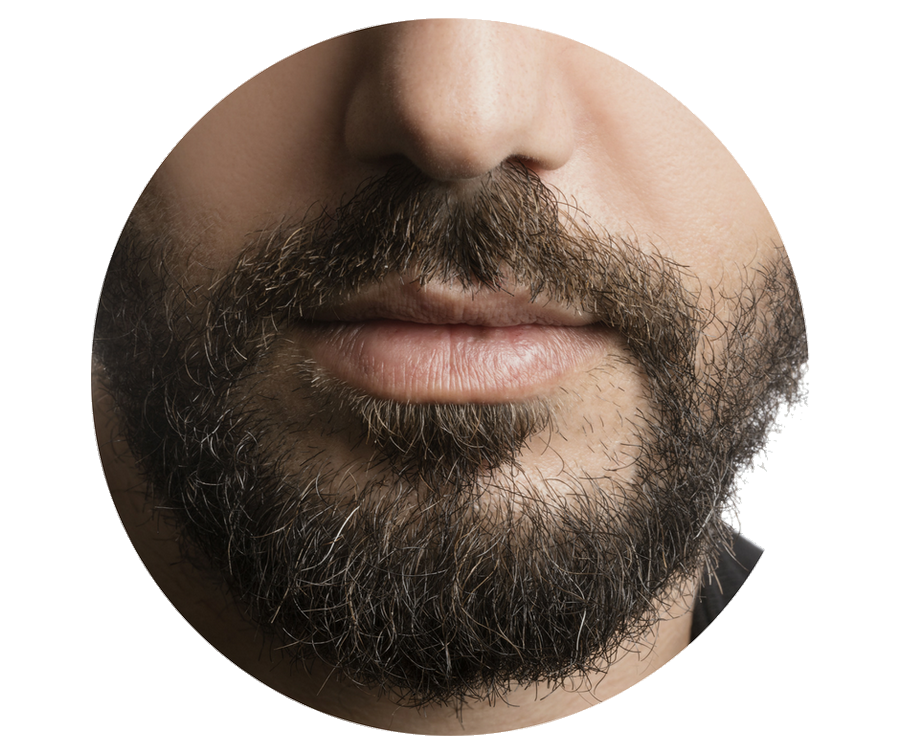 greffe de barbe paris